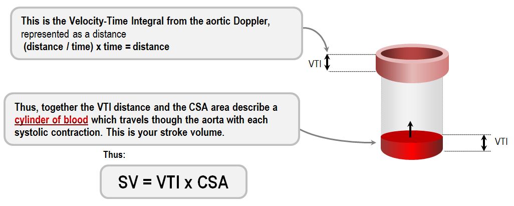 LVOT Doppler for estimation of cardiac output Deranged Physiology